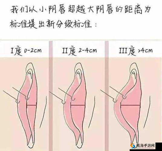 24 种阴脣图示：探索女性私密之美