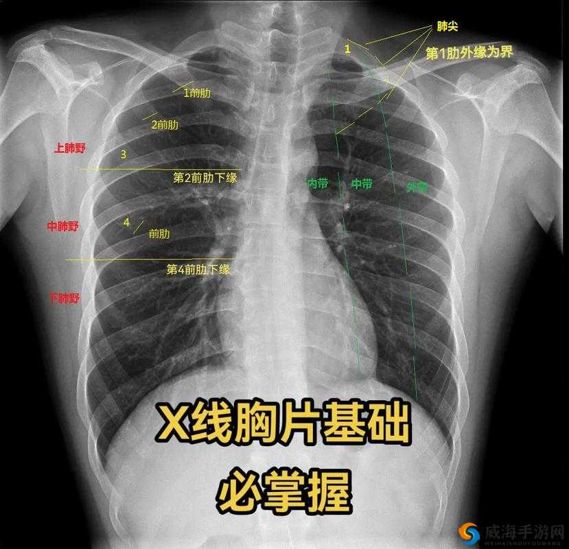 100%胸片曝光率软件可以直接看：提升医疗影像诊断效率的利器