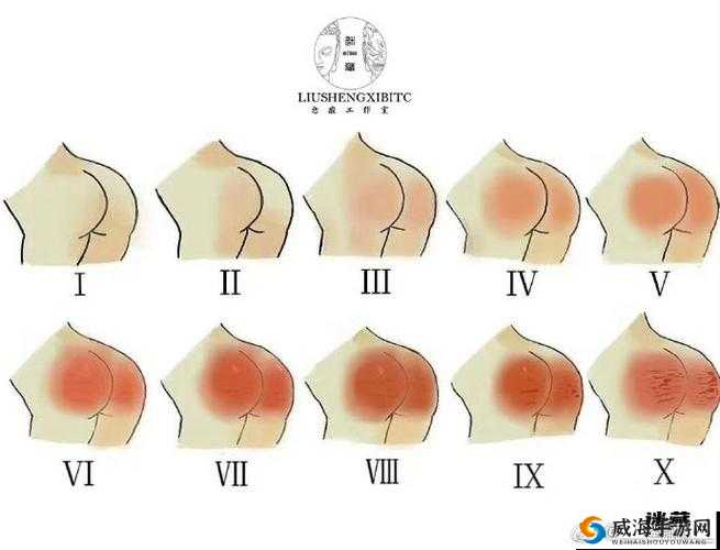 SP 发刷 红肿 双丘：探究背后的神秘现象与成因